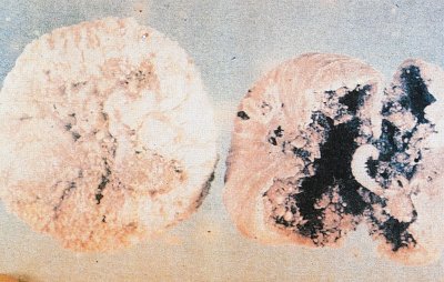 İncir kurdu zararına uğramış incir meyveleri